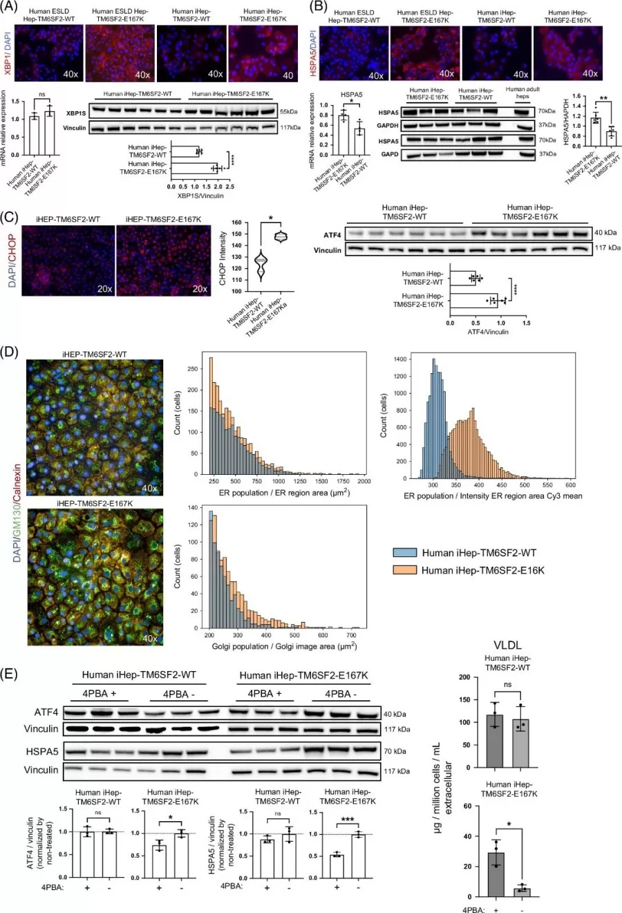 TM6SF2-E167K mutation is related to ER stress.